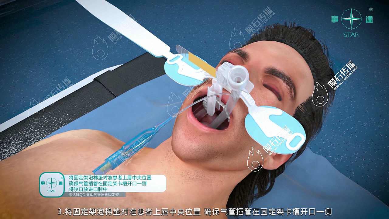 医疗手术动画：清晰呈现手术流程，专业不再晦涩​（图ZMzkzNjkyMTgw） - 动画片 - 站酷设计师陨石三维动画阿容原创素材 - 站酷ZCOOL