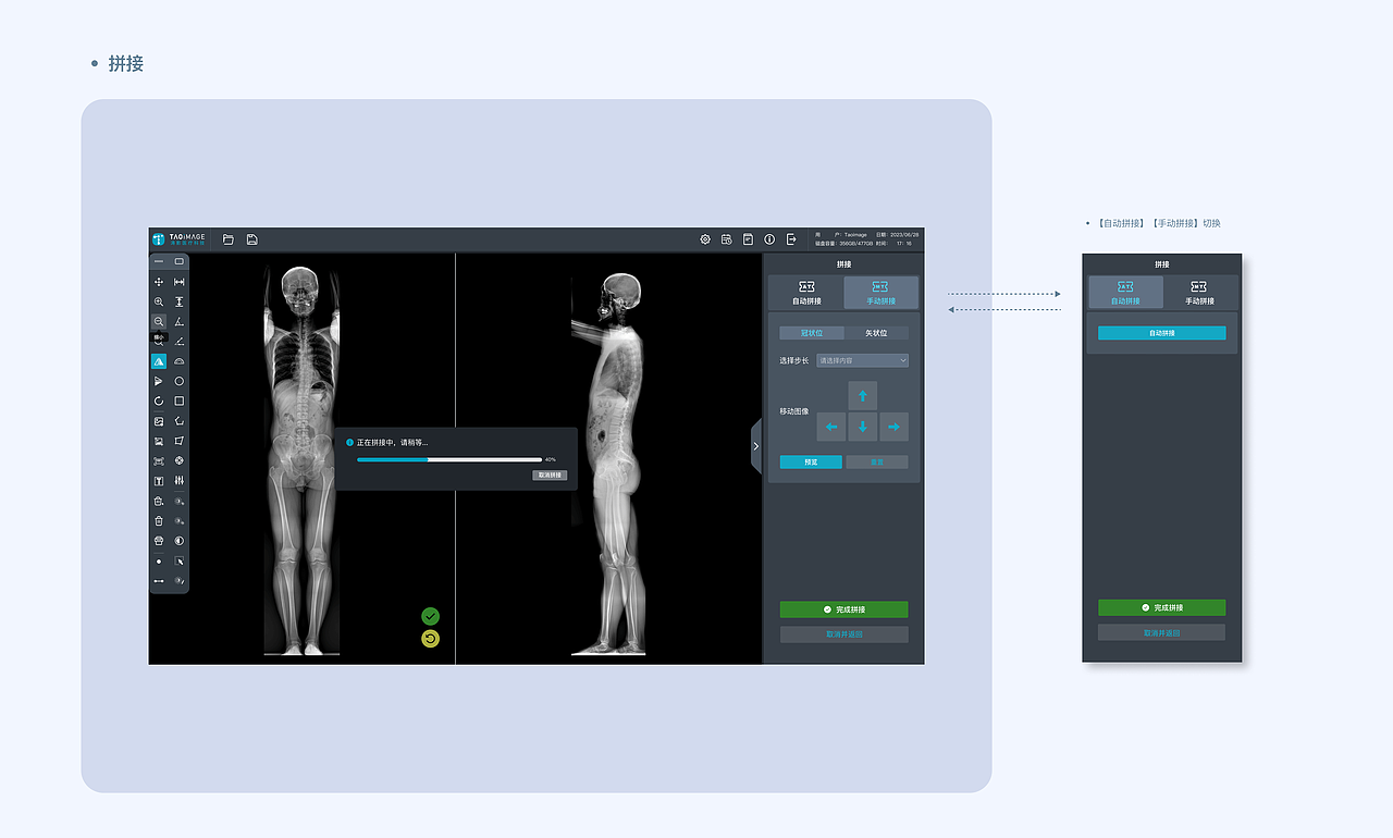 骨科X射线影像处理软件-UX&UI设计（图ZMzk0MTgwMDQ4） - 交互/UE - 站酷设计师木叶丸子原创素材 - 站酷ZCOOL