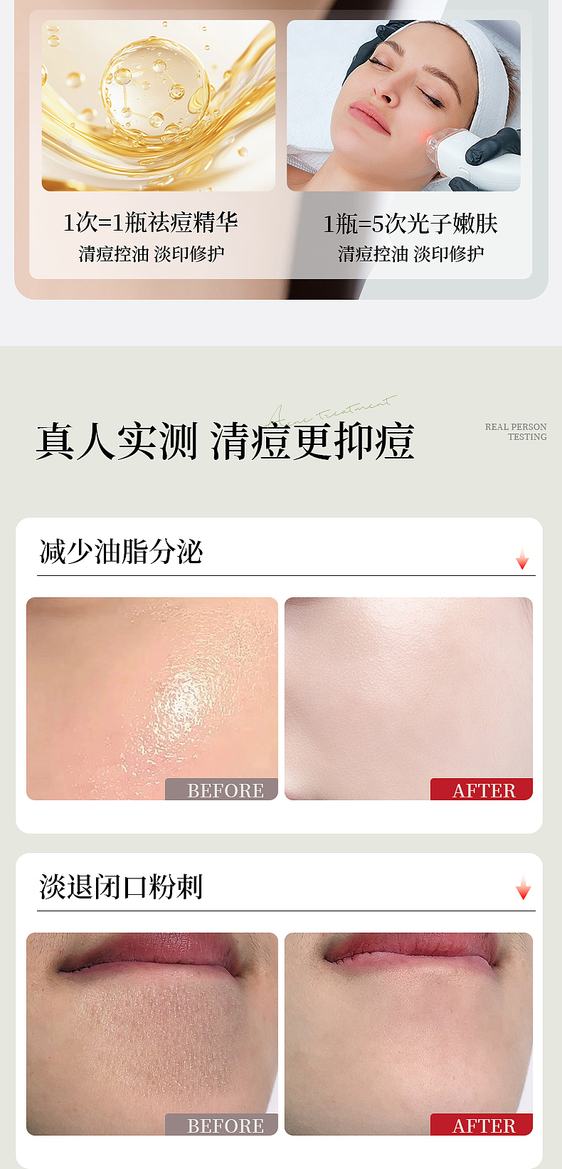 草本祛痘乳详情（图ZMzk0NjIyODE2） - 电商 - 站酷设计师JT作品原创素材 - 站酷ZCOOL