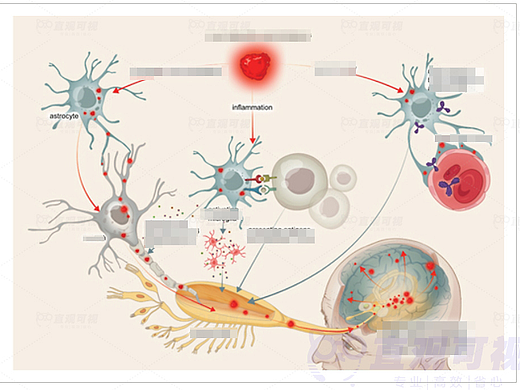 帕金森病嗅觉减退？这些血液标志物或能提前预警