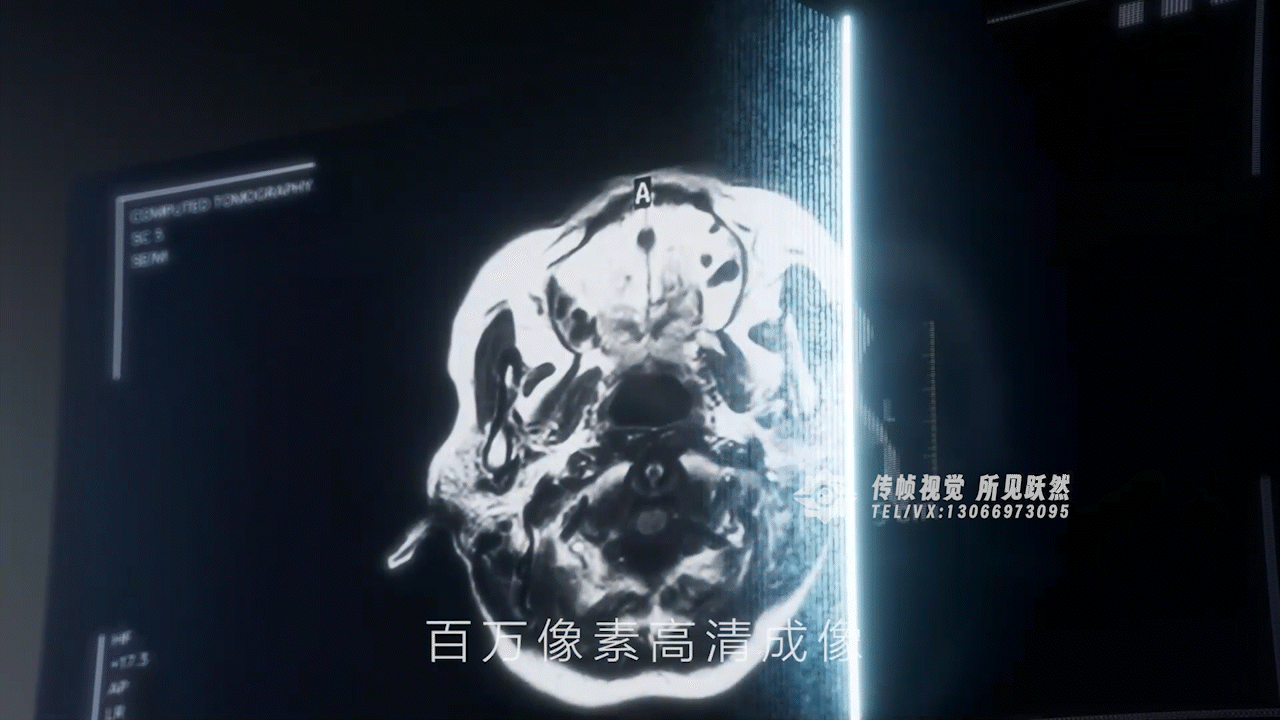 ScintCare Blue 755明峰医疗CT机（非商用）（图ZMzk2NTY4OTE2） - 产品 - 站酷设计师PDvision原创素材 - 站酷ZCOOL