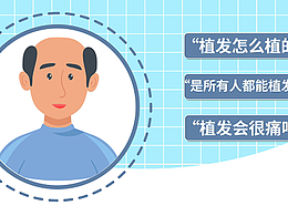 植发那些事？