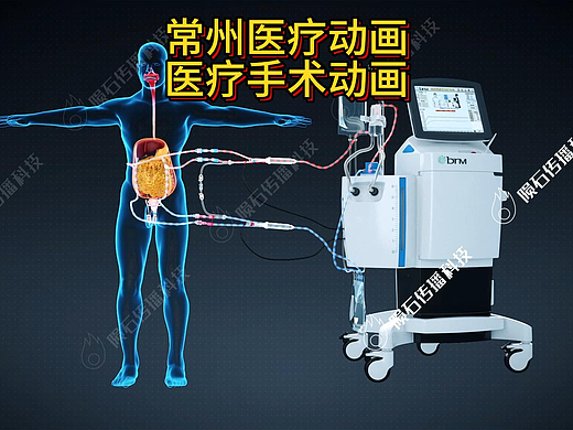 医疗可视化新选择！常州医疗动画，专业又精准