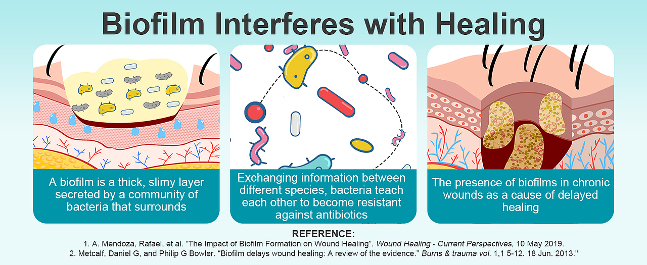 跨境-抗菌冲洗液（图ZMzk4MjU5MzQw） - 品牌 - 站酷设计师HXM天空之城原创素材 - 站酷ZCOOL