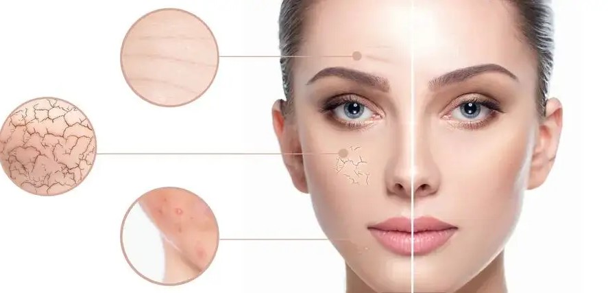 敏感肌干皮速来！2025年超温和保湿面膜深度实测，保湿力MAX不踩雷