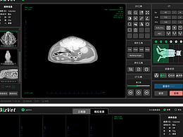 动物CT系统