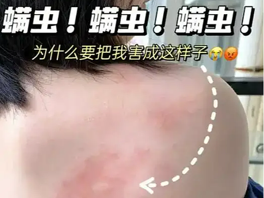 除螨仪哪家比较好？十大高品质除螨仪品牌排行榜出炉！全网独一份