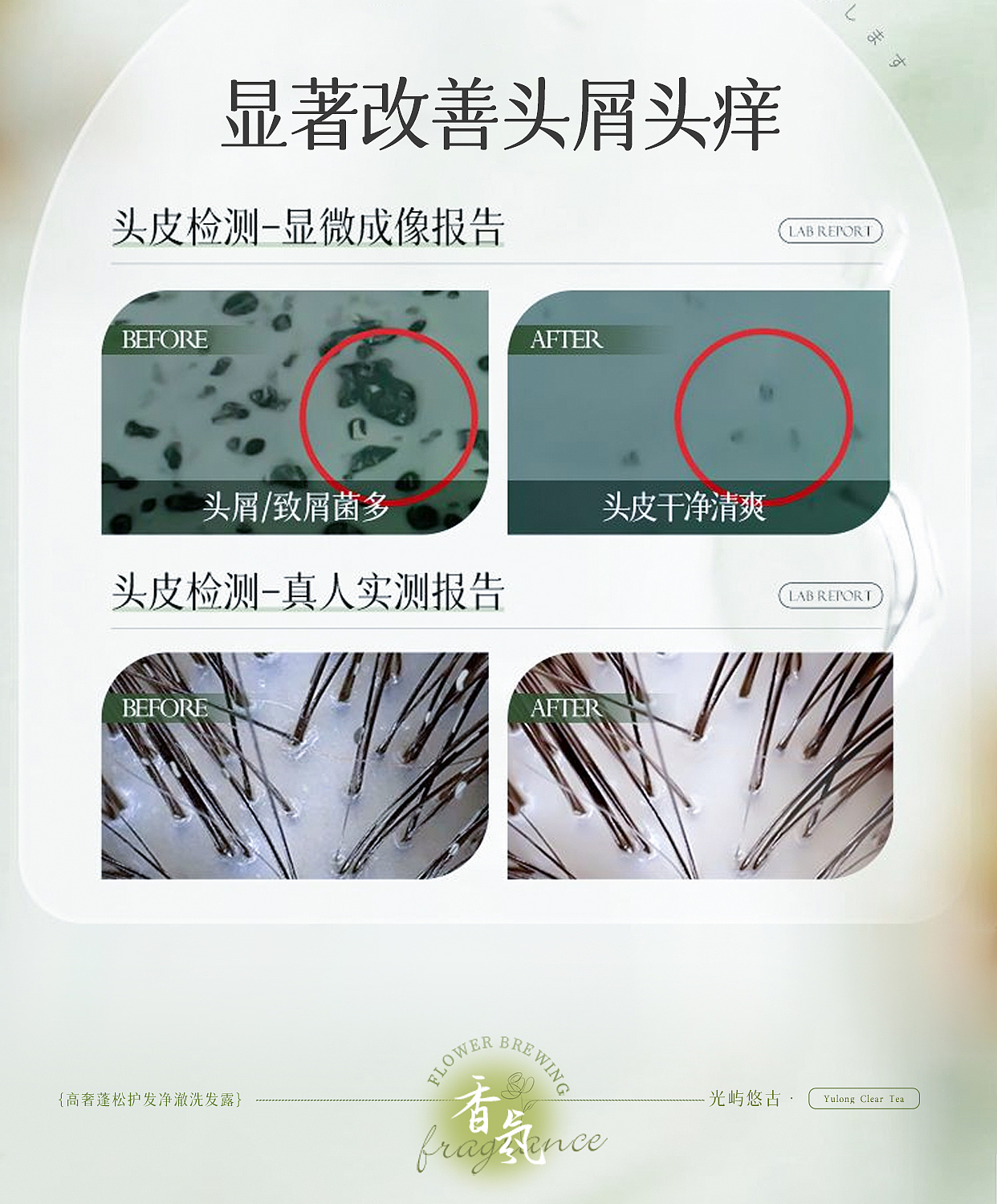 洗发水（图ZMzk5MzQ3OTE2） - 电商 - 站酷设计师Z40691618原创素材 - 站酷ZCOOL