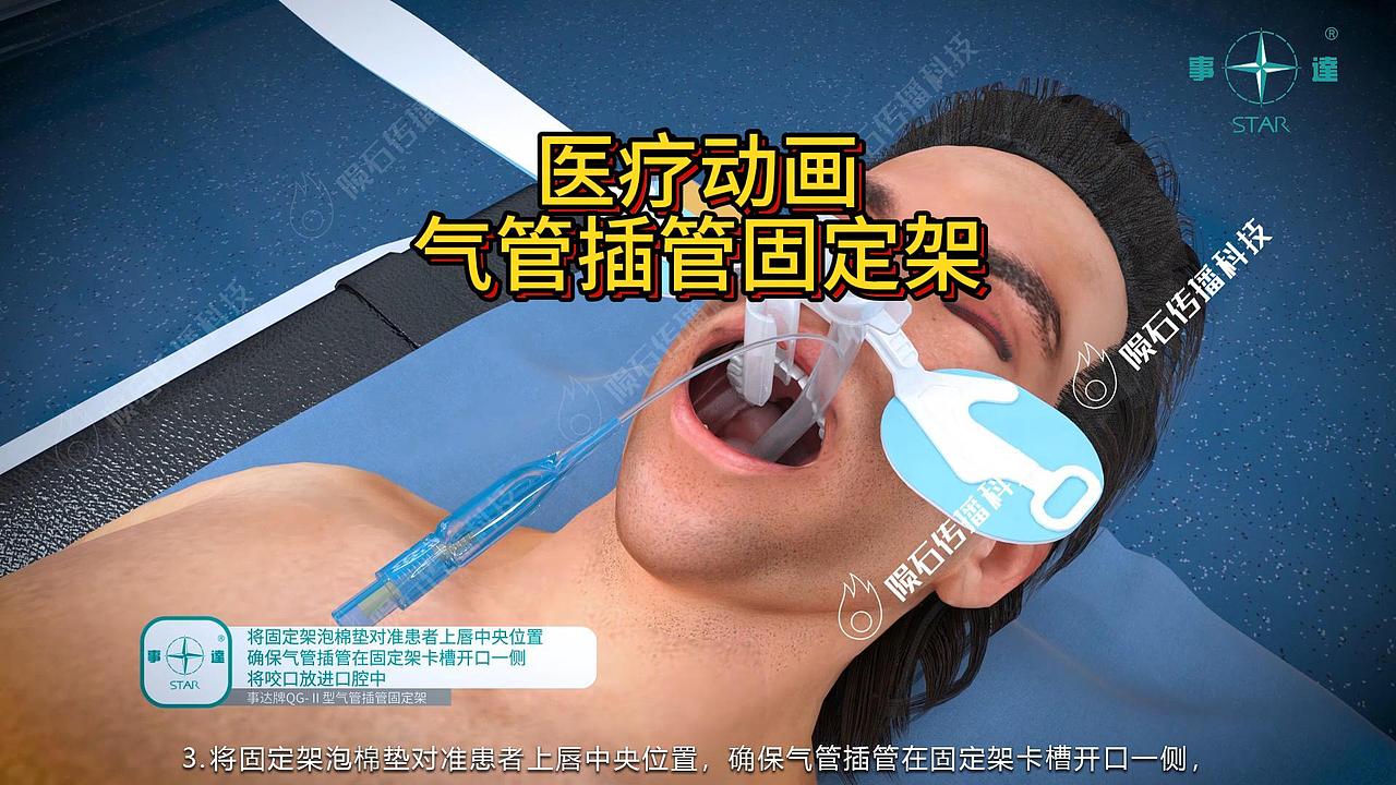气管插管固定架核心卖点：医疗三维动画直观呈现