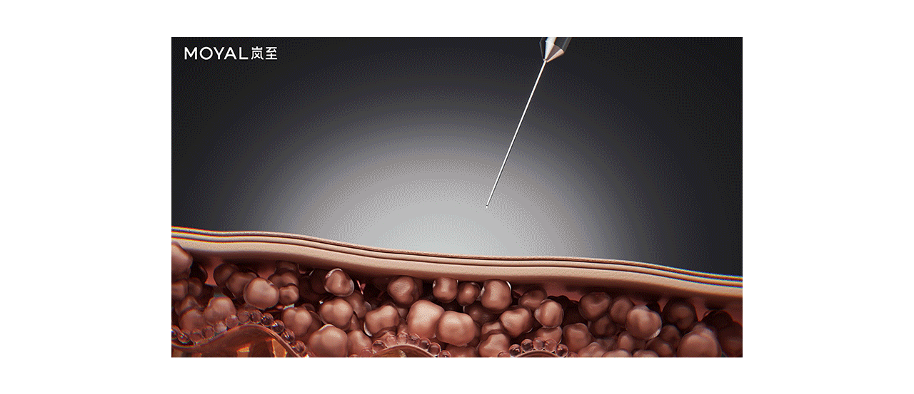 MOYAL岚至 雾光炮 医美院线美容仪 医疗器械 CG动画TVC