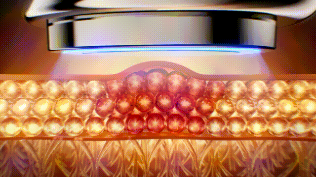 产品动画 | 射频美容仪