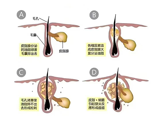 雅肤兰带您迈向健康美丽肌肤