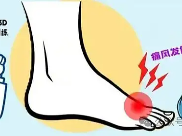 痛风克星来了！58种食物中，这4种是真正的降尿酸“高手”！