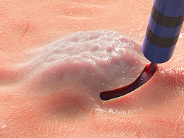 消化道内镜动画