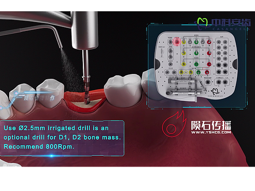 种植牙科动画的制作周期受哪些因素影响?