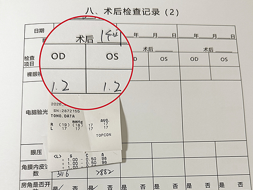 天津普瑞眼科医院张海燕主任巧施ICL晶体植入术，解决患者双眼屈光参差难题