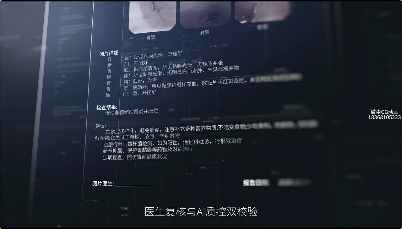 安翰科技智能模块化磁控胶囊内窥镜/胃镜（图ZNDA0NTYxNTQw） - 动画/影视 - 站酷设计师微尘CG动画原创素材 - 站酷ZCOOL