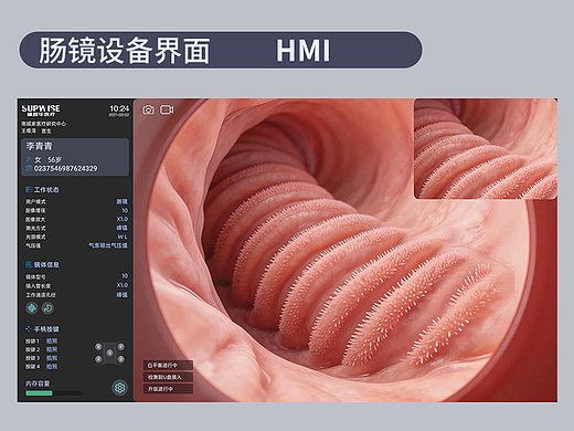 肠镜设备界面