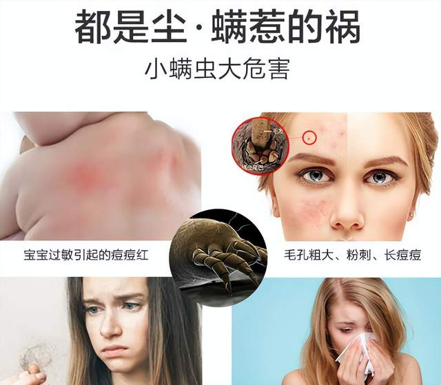 友望除螨仪怎么样？哪一款除螨仪比较好用？全维度测评十大公认好用的除螨仪排名！（图ZMTU1NDQ4ODg=） - 资讯 - 站酷设计师木子将家电原创素材 - 站酷ZCOOL