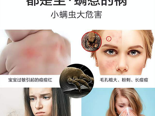 友望除螨仪怎么样？哪一款除螨仪比较好用？全维度测评十大公认好用的除螨仪排名！