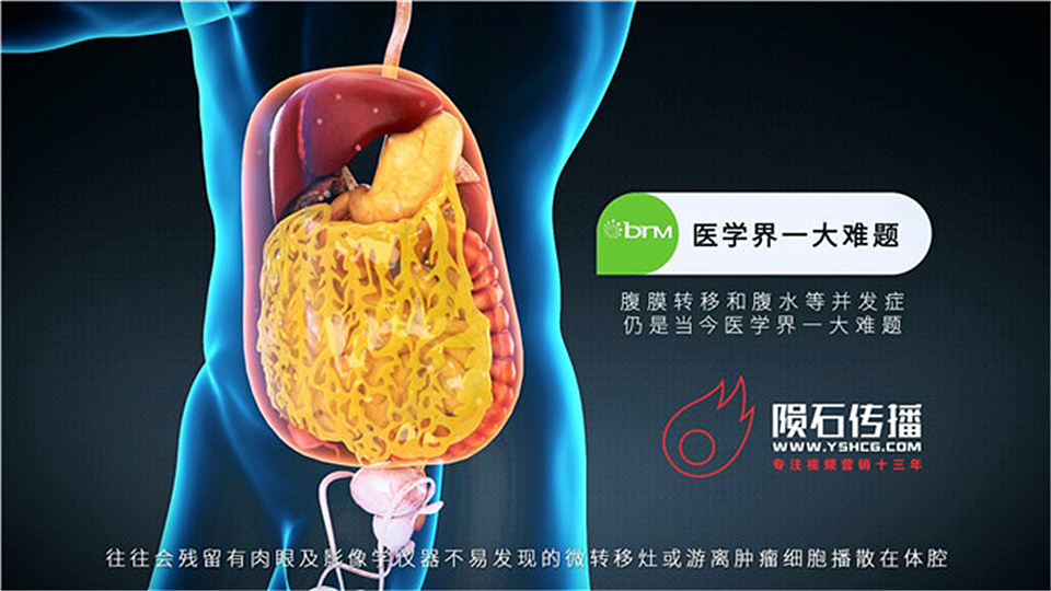 超立体深圳医疗动画，拆解各类医疗技术（图ZNDA2MTMyOTQ4） - 动画片 - 站酷设计师陨石三维动画阿容原创素材 - 站酷ZCOOL