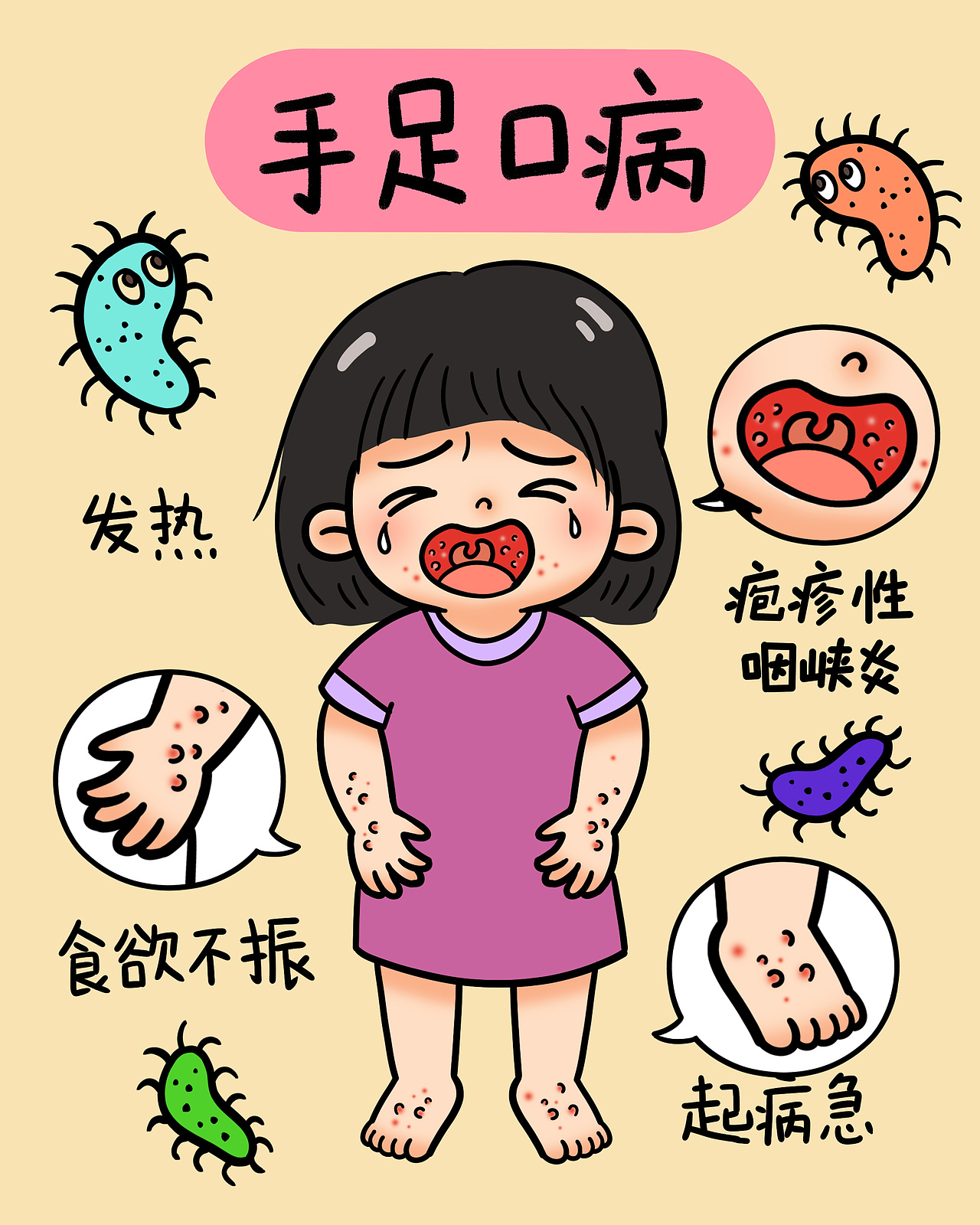 手足口病宣传海报（图ZNDA2NTIyMjc2） - 创作习作 - 站酷设计师WiKi的宝藏原创素材 - 站酷ZCOOL