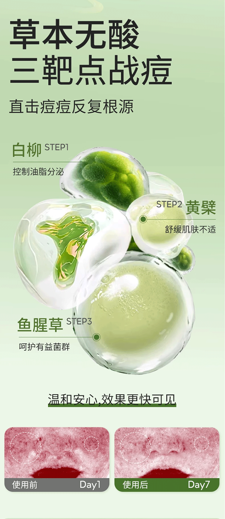 全网销量300多万的祛痘凝胶详情页是怎么样的呢?(图ZNDA5NDE0NDQ0) - 电商 - 站酷设计师姚天辰原创素材 - 站酷ZCOOL
