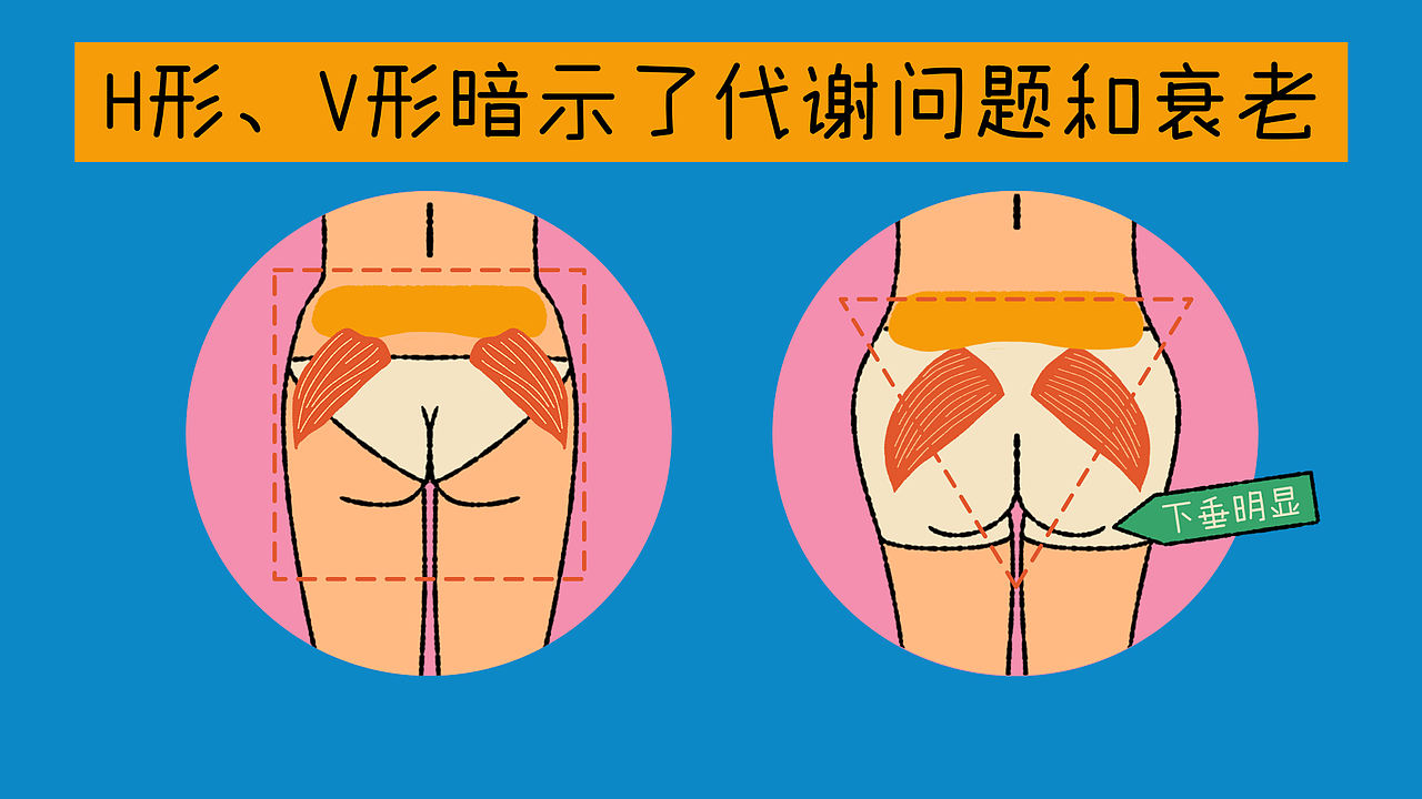 如何获得完美和健康的臀型？（图ZNDExNTI1MTA4） - 短片 - 站酷设计师Erye1993原创素材 - 站酷ZCOOL