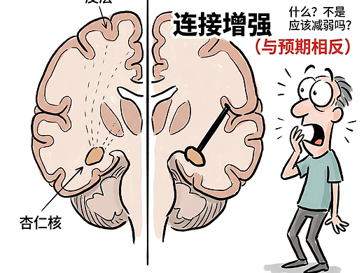 你以为抗焦虑药让你变麻木？其实让大脑更紧密地连接了
